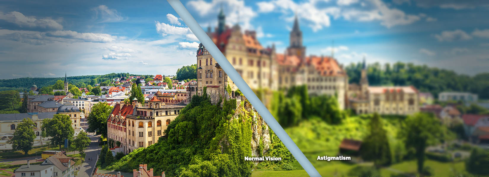 Astigmatism Treatment in Sanford