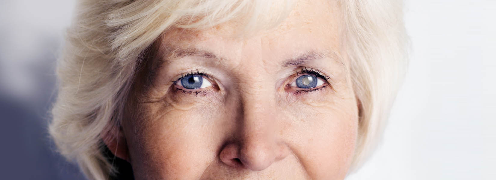 Cataract Surgery in Sanford