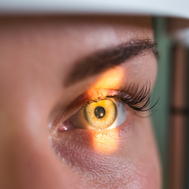 Vision Therapy in Sanford